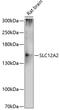 Solute Carrier Family 12 Member 2 antibody, 14-095, ProSci, Western Blot image 