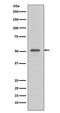 TNF receptor-associated factor 4 antibody, M03069, Boster Biological Technology, Western Blot image 