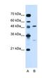 Colony Stimulating Factor 1 antibody, orb325139, Biorbyt, Western Blot image 
