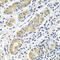 Retinoic acid-induced protein 3 antibody, 23-445, ProSci, Immunohistochemistry paraffin image 