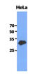 Glutamate-Cysteine Ligase Modifier Subunit antibody, AM50016PU-N, Origene, Western Blot image 