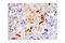 Insulin Like Growth Factor Binding Protein 1 antibody, 31025T, Cell Signaling Technology, Immunohistochemistry paraffin image 