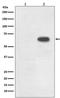 Cell Division Cycle 6 antibody, P01355, Boster Biological Technology, Western Blot image 