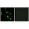 Cadherin 10 antibody, A10616, Boster Biological Technology, Immunohistochemistry paraffin image 
