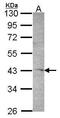 Serine/Threonine Kinase 17a antibody, GTX102375, GeneTex, Western Blot image 
