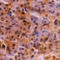 Ubiquitin B antibody, SM1422P, Origene, Immunohistochemistry paraffin image 