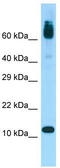 Acylphosphatase 1 antibody, TA334096, Origene, Western Blot image 