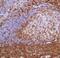 Sialophorin antibody, MA5-16339, Invitrogen Antibodies, Immunohistochemistry frozen image 