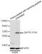 Zeta Chain Of T Cell Receptor Associated Protein Kinase 70 antibody, MBS128571, MyBioSource, Western Blot image 