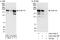 CAP-Gly Domain Containing Linker Protein 1 antibody, A303-345A, Bethyl Labs, Immunoprecipitation image 