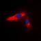Actinin Alpha 3 (Gene/Pseudogene) antibody, orb213520, Biorbyt, Immunofluorescence image 