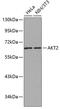 AKT Serine/Threonine Kinase 2 antibody, 13-146, ProSci, Western Blot image 