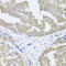 Translocase Of Inner Mitochondrial Membrane 10B antibody, 23-618, ProSci, Immunohistochemistry paraffin image 