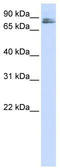 Transmembrane And Coiled-Coil Domains 3 antibody, TA342047, Origene, Western Blot image 