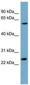 Leucine Rich Repeat Containing 6 antibody, TA335648, Origene, Western Blot image 