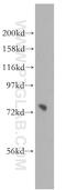 Phosphatidylinositol Glycan Anchor Biosynthesis Class O antibody, 16369-1-AP, Proteintech Group, Western Blot image 