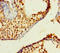 Zinc Finger Protein 800 antibody, A64032-100, Epigentek, Immunohistochemistry paraffin image 