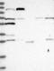 Leucine Rich Repeat Containing G Protein-Coupled Receptor 4 antibody, NBP1-89737, Novus Biologicals, Western Blot image 