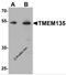 Transmembrane Protein 135 antibody, 7291, ProSci Inc, Western Blot image 
