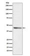 Ribonucleotide Reductase Regulatory Subunit M2 antibody, M01978, Boster Biological Technology, Western Blot image 