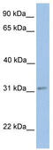 Enoyl-CoA Hydratase Domain Containing 2 antibody, TA346864, Origene, Western Blot image 