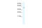 Transmembrane Protein 108 antibody, 28-503, ProSci, Western Blot image 