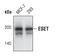 SET Domain Bifurcated Histone Lysine Methyltransferase 1 antibody, MA5-14960, Invitrogen Antibodies, Western Blot image 
