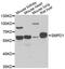 Sphingomyelin Phosphodiesterase 1 antibody, MBS9125583, MyBioSource, Western Blot image 
