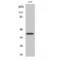 Tumor Associated Calcium Signal Transducer 2 antibody, LS-C386510, Lifespan Biosciences, Western Blot image 