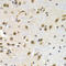 Lamin B Receptor antibody, LS-C335572, Lifespan Biosciences, Immunohistochemistry paraffin image 