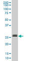 TGFB Induced Factor Homeobox 2 antibody, LS-C139538, Lifespan Biosciences, Western Blot image 