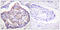 Vinculin antibody, LS-C199725, Lifespan Biosciences, Immunohistochemistry paraffin image 