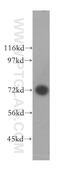 Glycyl-TRNA Synthetase antibody, 15831-1-AP, Proteintech Group, Western Blot image 