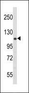 Eukaryotic Translation Initiation Factor 2 Alpha Kinase 3 antibody, GTX81222, GeneTex, Western Blot image 