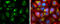Cathepsin D antibody, GTX133019, GeneTex, Immunofluorescence image 
