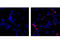 Hematopoietic Cell-Specific Lyn Substrate 1 antibody, 13708S, Cell Signaling Technology, Immunocytochemistry image 