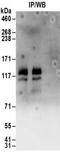 Diphosphoinositol Pentakisphosphate Kinase 2 antibody, NBP2-32154, Novus Biologicals, Immunoprecipitation image 