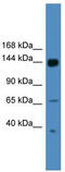 UPF2 Regulator Of Nonsense Mediated MRNA Decay antibody, TA343831, Origene, Western Blot image 