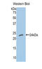 Major Histocompatibility Complex, Class II, DR Alpha antibody, LS-C295280, Lifespan Biosciences, Western Blot image 