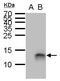 Peptidase Inhibitor 3 antibody, PA5-35878, Invitrogen Antibodies, Western Blot image 