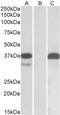 Pim-2 Proto-Oncogene, Serine/Threonine Kinase antibody, LS-B10470, Lifespan Biosciences, Western Blot image 