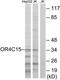 Olfactory Receptor Family 4 Subfamily C Member 15 antibody, TA315846, Origene, Western Blot image 