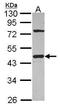 G Protein Subunit Alpha I1 antibody, GTX114437, GeneTex, Western Blot image 