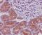 Eukaryotic Translation Initiation Factor 2 Alpha Kinase 2 antibody, M01384, Boster Biological Technology, Immunohistochemistry paraffin image 