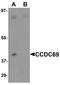 Coiled-Coil Domain Containing 69 antibody, NBP1-77145, Novus Biologicals, Western Blot image 