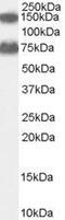 ACOX2 antibody, GTX89116, GeneTex, Western Blot image 