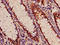 Acylaminoacyl-Peptide Hydrolase antibody, LS-C394610, Lifespan Biosciences, Immunohistochemistry paraffin image 