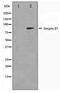 Integrin Subunit Beta 5 antibody, TA347406, Origene, Western Blot image 
