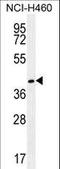 Gamma-Glutamyl Hydrolase antibody, LS-C166456, Lifespan Biosciences, Western Blot image 