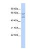 Zinc Finger Protein 415 antibody, NBP1-80340, Novus Biologicals, Western Blot image 